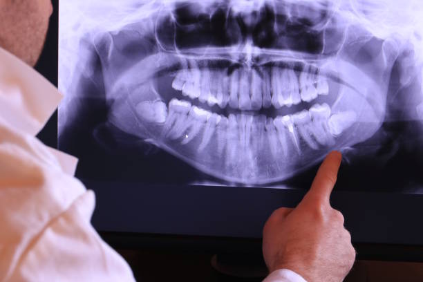 Best Emergency Broken Tooth Repair in Yorkshire, VA